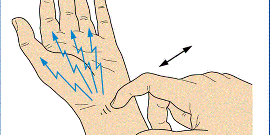 تست تینل (Tinel’s test)