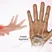 درد مچ دست و کف دست سندروم کارپال تانل (Carpal Tunnel Syndrome